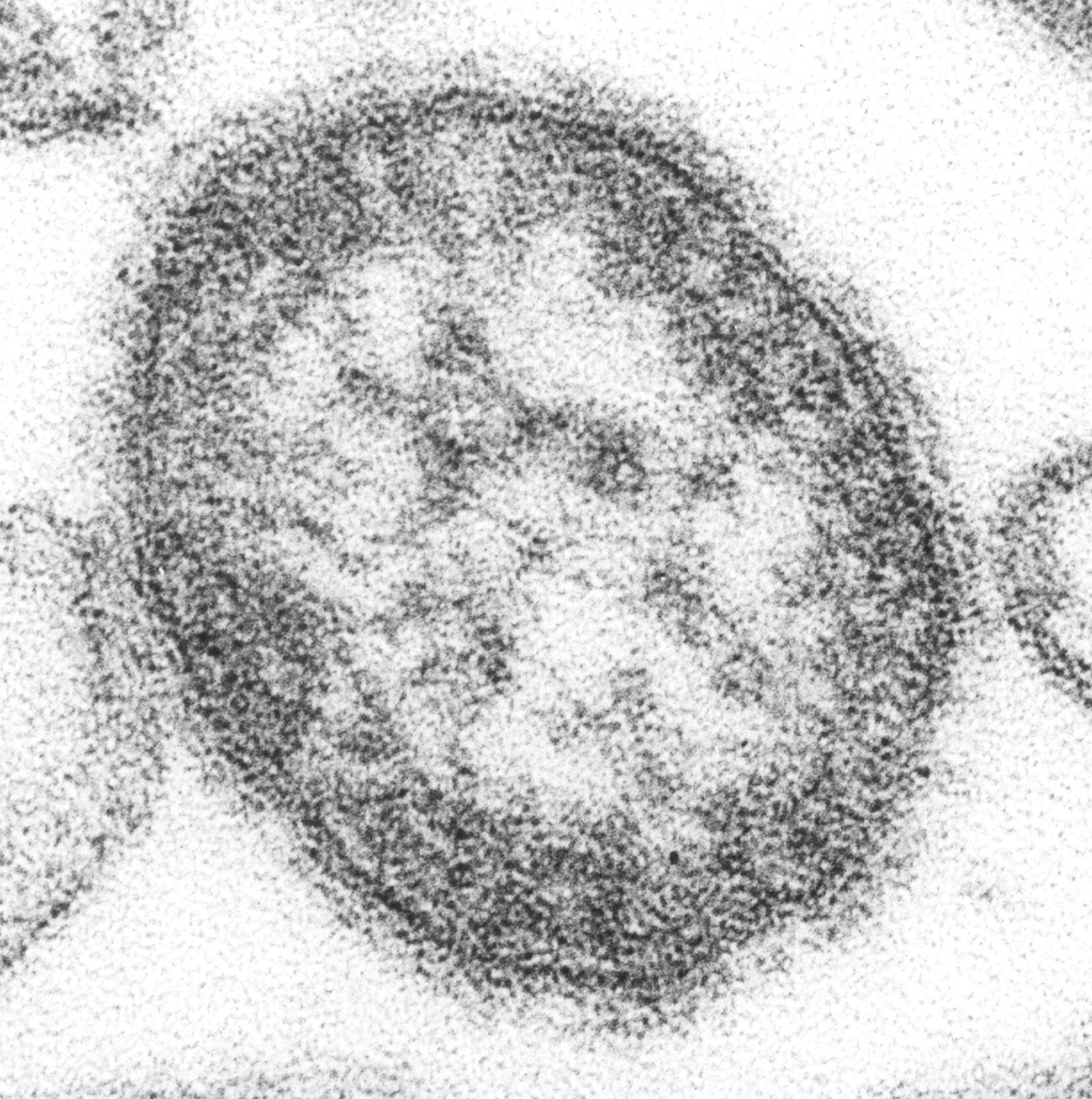 Colorized transmission electron micrograph of a measles virus particle